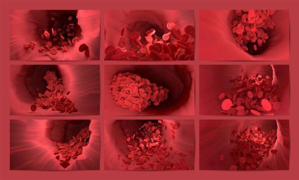 verschiedene arterien